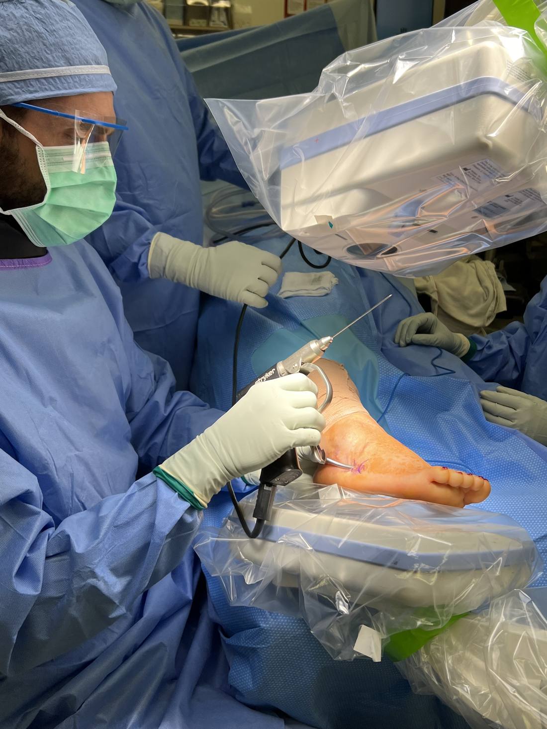 Minimally invasive foot surgery being performed with a specialized handpiece